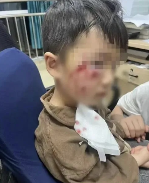 被瘋?cè)麤](méi)有“救命藥”，怎么辦？